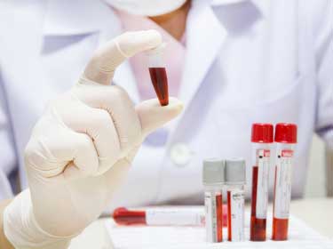PHCbi Blood Sample Storage